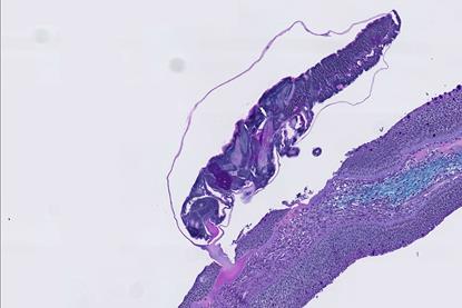 A sea louse (on top) attaches itself to a fish fin