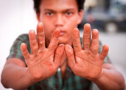 Reports of assault, threats at gunpoint and beatings by shelter staff leading to severe injuries have been recorded by EJF